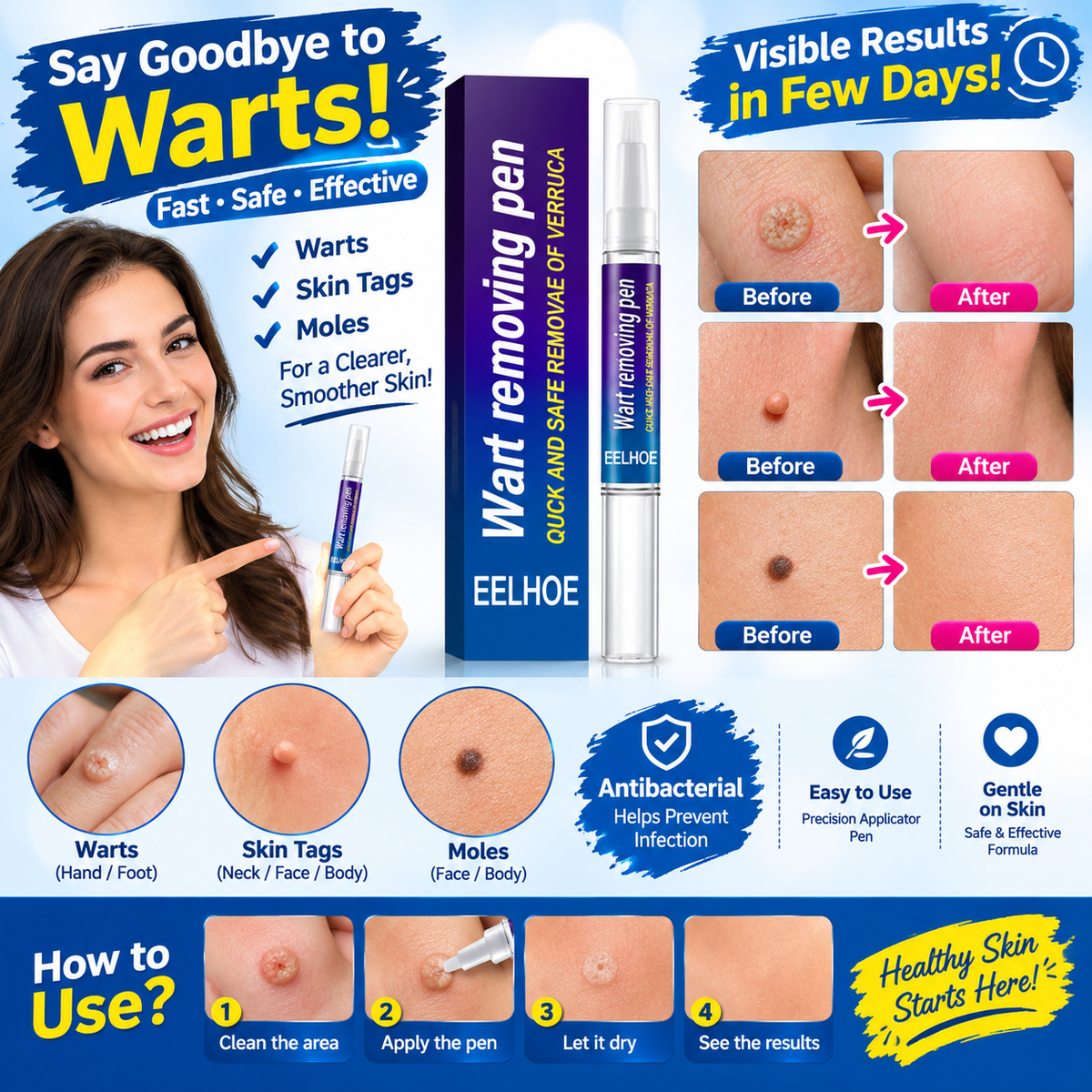 π©Ή Wart Remover Gel Pen β Complete Shopify Product Listing