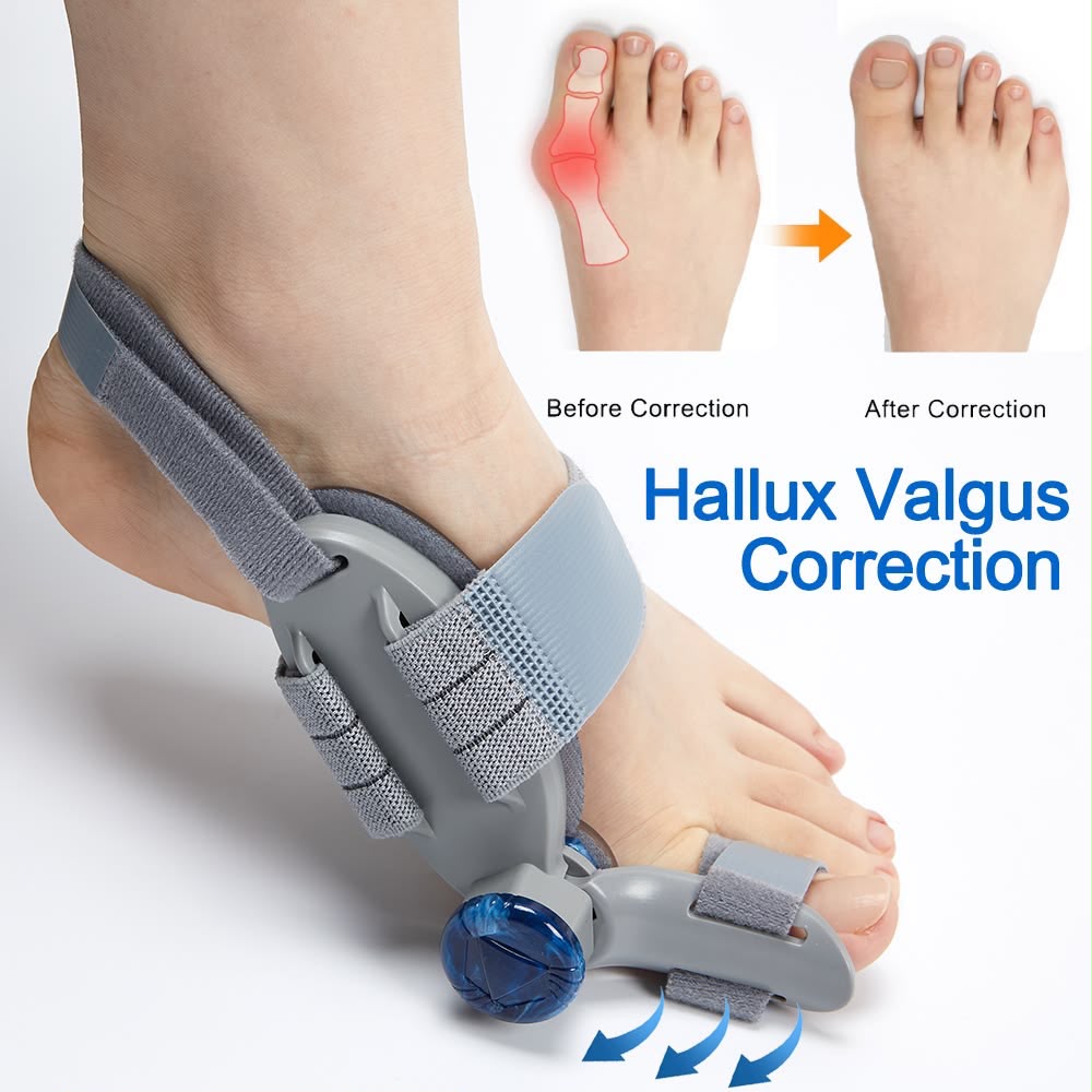 Ortho Life Hinged Bunion Splint | Adjustable Big Toe Corrector Brace for Hallux Valgus Pain Relief